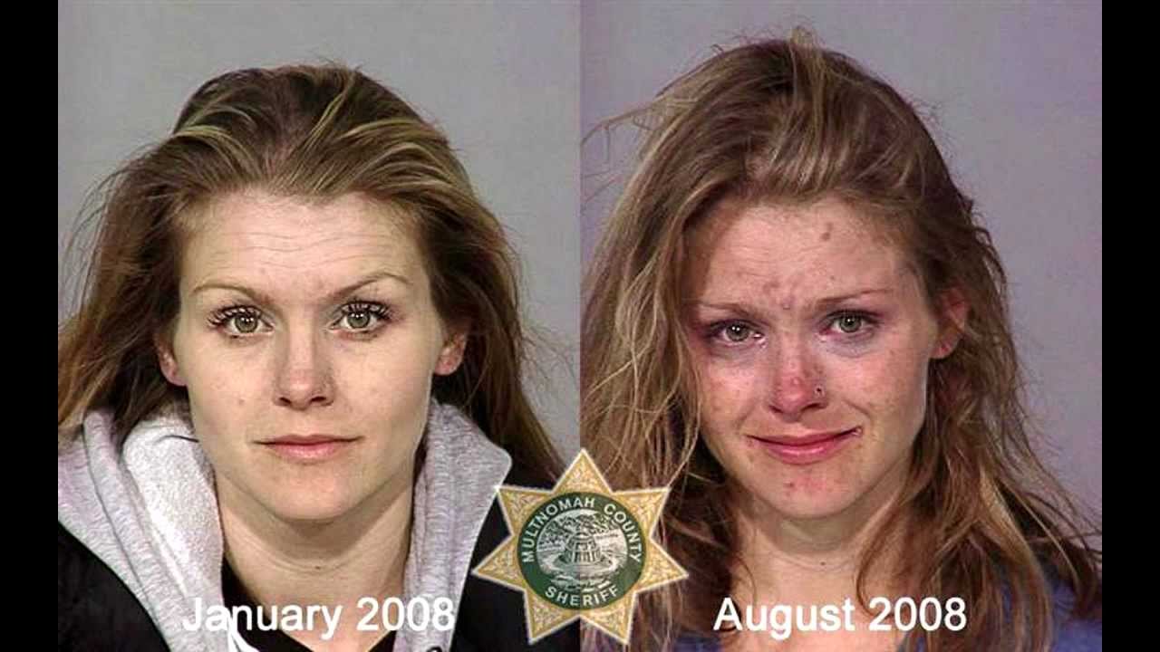 Drugs Abuse: Faces Before and After; Addicted Condition